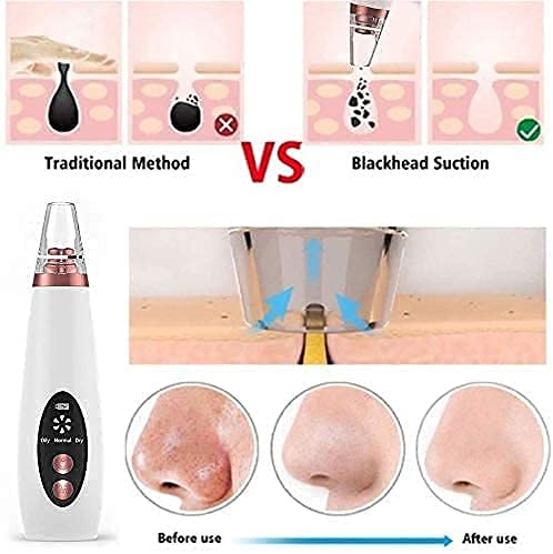 Glow effortlessly with the Blackhead Removal Machine